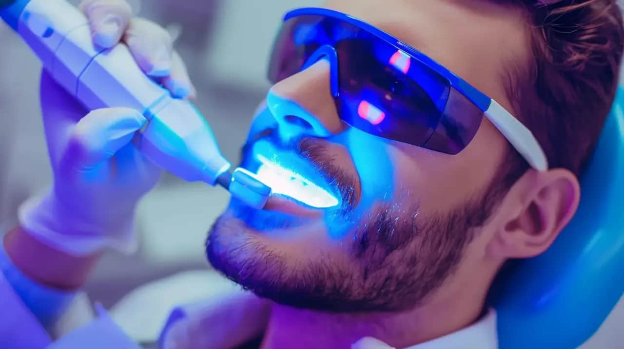 Wybielanie zębów: Jak wybrać najlepszą i bezpieczną metodę?